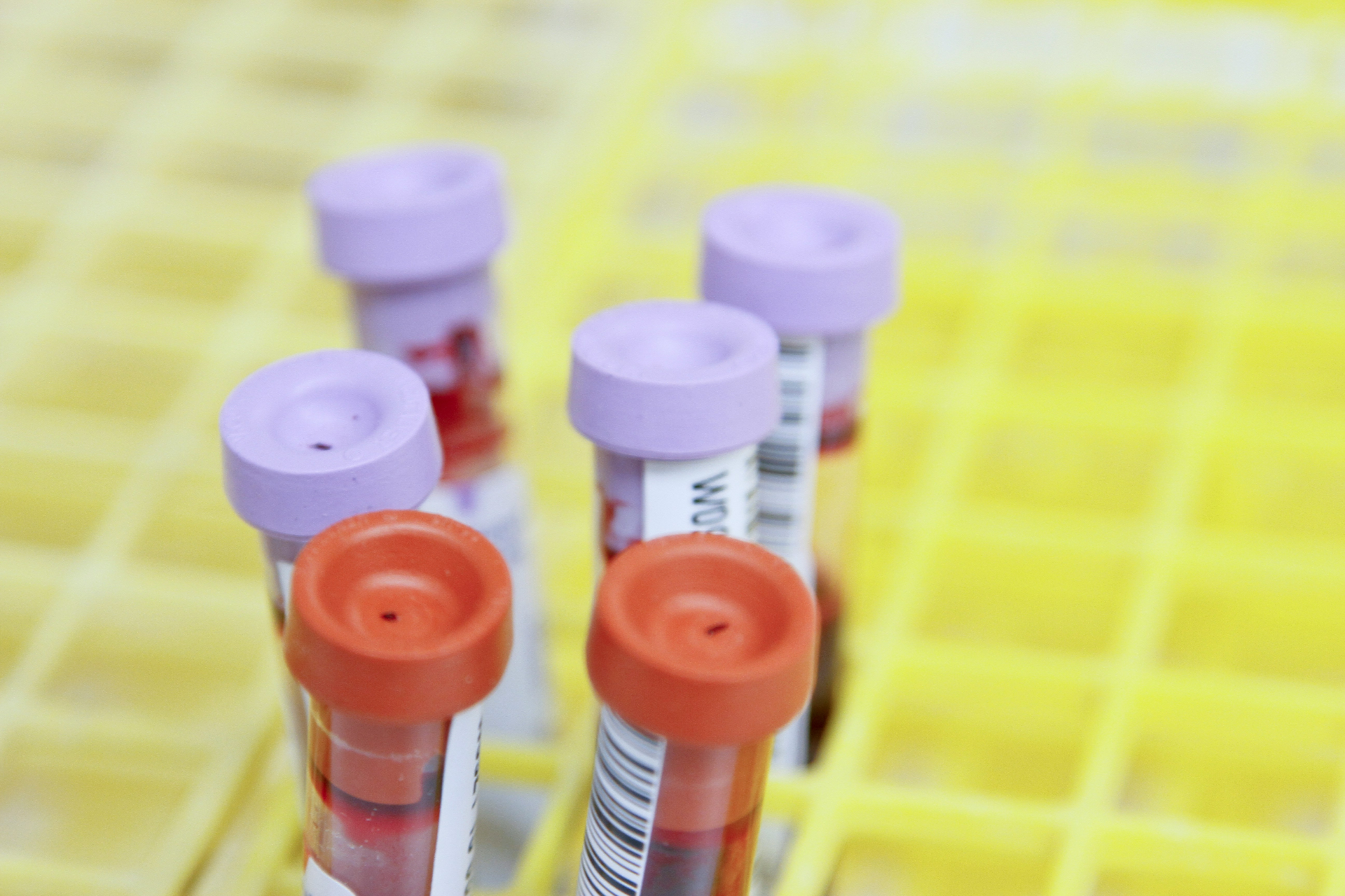 Positive blood culture tubes for sepsis diagnostics and PBC cleanup testing