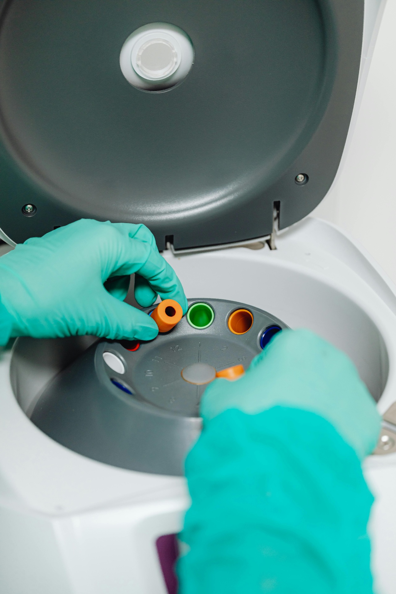 Streamlined sepsis diagnostic workflow with BugSee rapid sample preparation